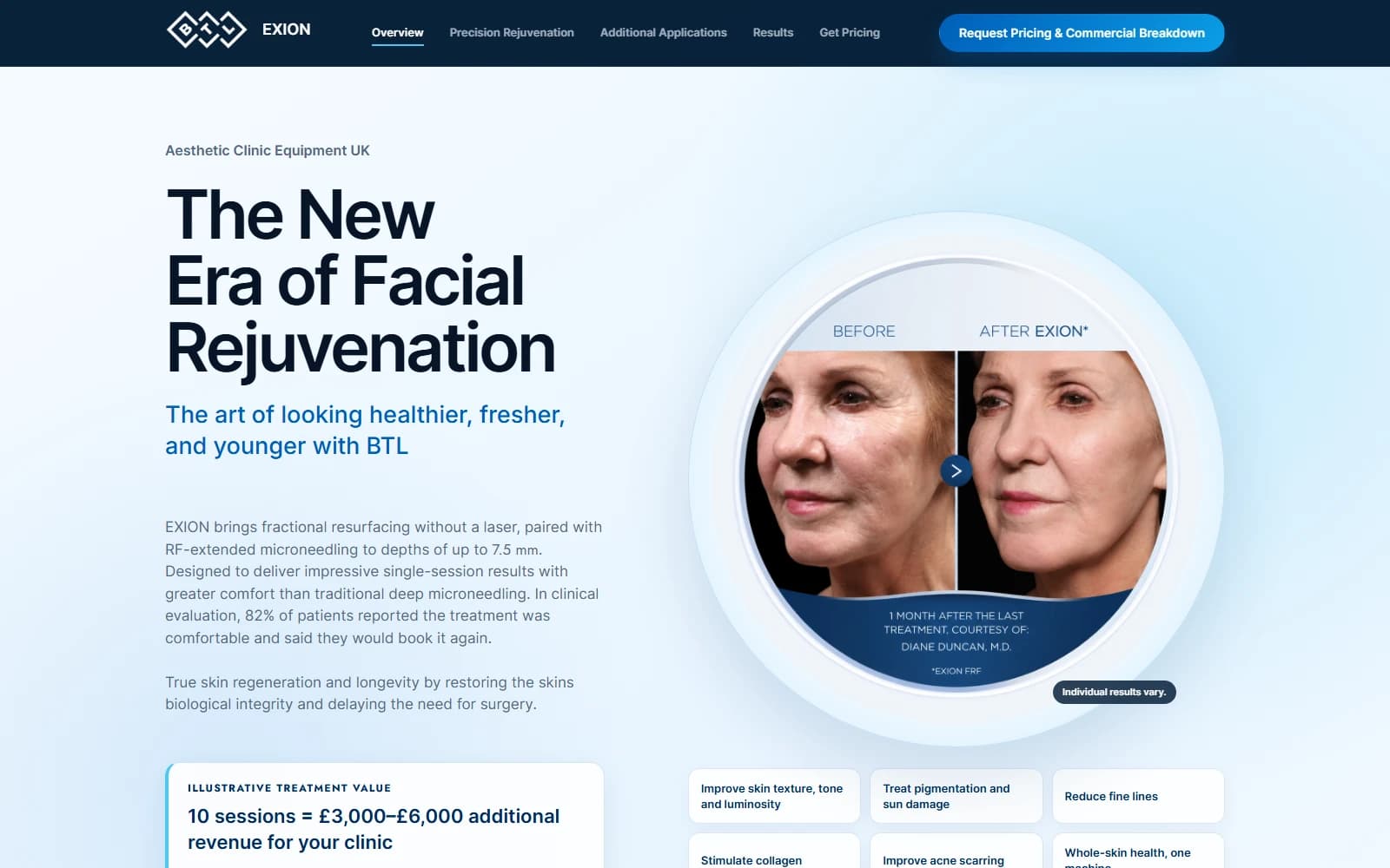 Screenshot of the Exion by BTL website interface
